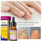 MOIKA Nail Renewal Drops Fungal Nail Repair Toenail Growth Treatment