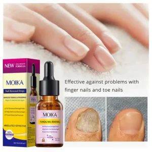 MOIKA Nail Renewal Drops Fungal Nail Repair Toenail Growth Treatment
