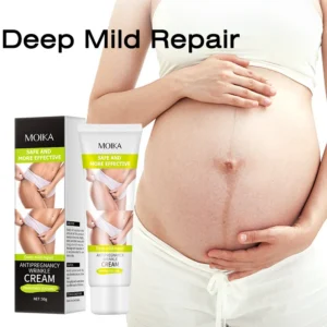 MOIKA Deep Mild Repair Cream for Stretch Marks & Pregnancy Lines