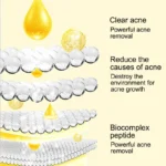 Salicylic Acne Essence Water Spu979217450004 3