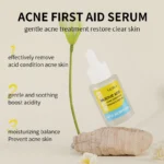 Salicylic Acne Removing Serum Spu764637554094 2