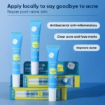 Salicylic Acne Treatment Gel Spu696416345059 2