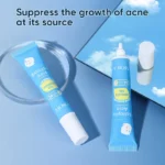 Salicylic Acne Treatment Gel Spu696416345059 3