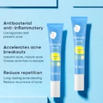 Salicylic Acne Treatment Gel Spu696416345059 4