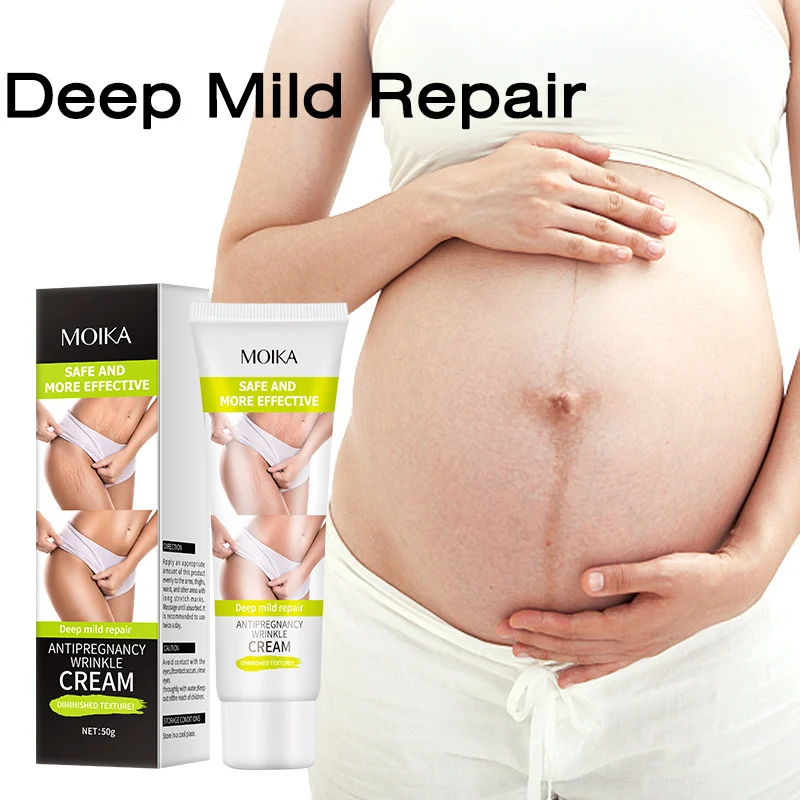 stretch-mark-repair-cream-spu704286310208-1 MOIKA Deep Mild Repair Stretch Mark Cream for Pregnancy & Postpartum